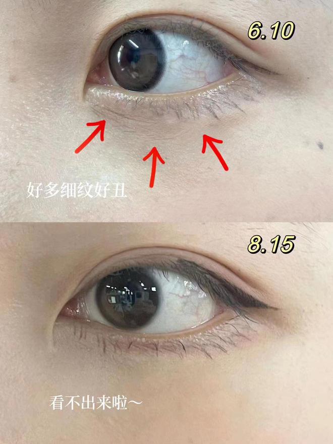 眼霜！熬夜测评总结十大眼霜品牌揭秘OG真人游戏去眼袋公认最好用10大(图9)
