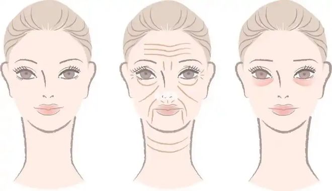 目比较好？几天见效术后案例医院OG真人想要眼部提升做什么项