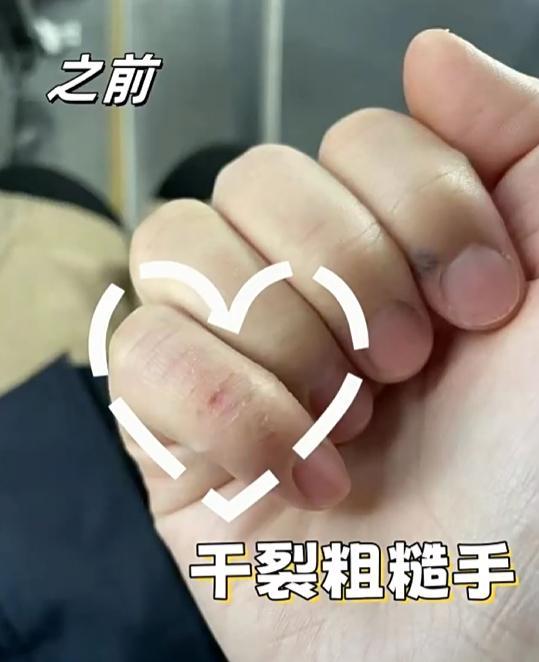 手霜哪种好保湿滋润？一篇终极盘点！OG真人护手霜如何购买推荐品牌护(图2)